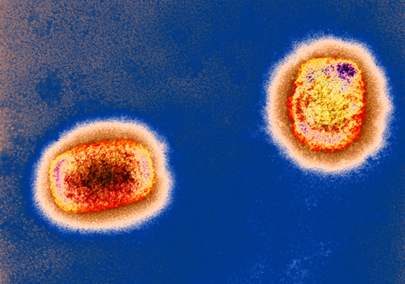 Monkeypox virus | Photo: UK HEALTH SECURITY AGENCY / SCIENCE PHOTO LIBRARY