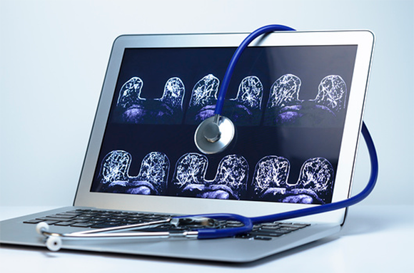 A stethoscope and an MRI image of a healthy breast. Photo: Turtle Rock Scientific / Science Source / Science Photo Library