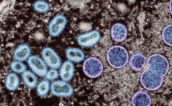 Can cause disease in humans and monkeys, but its main hosts are rodents. Monkeypox virus from a human skin sample | Source: CDC, Science Photo Library